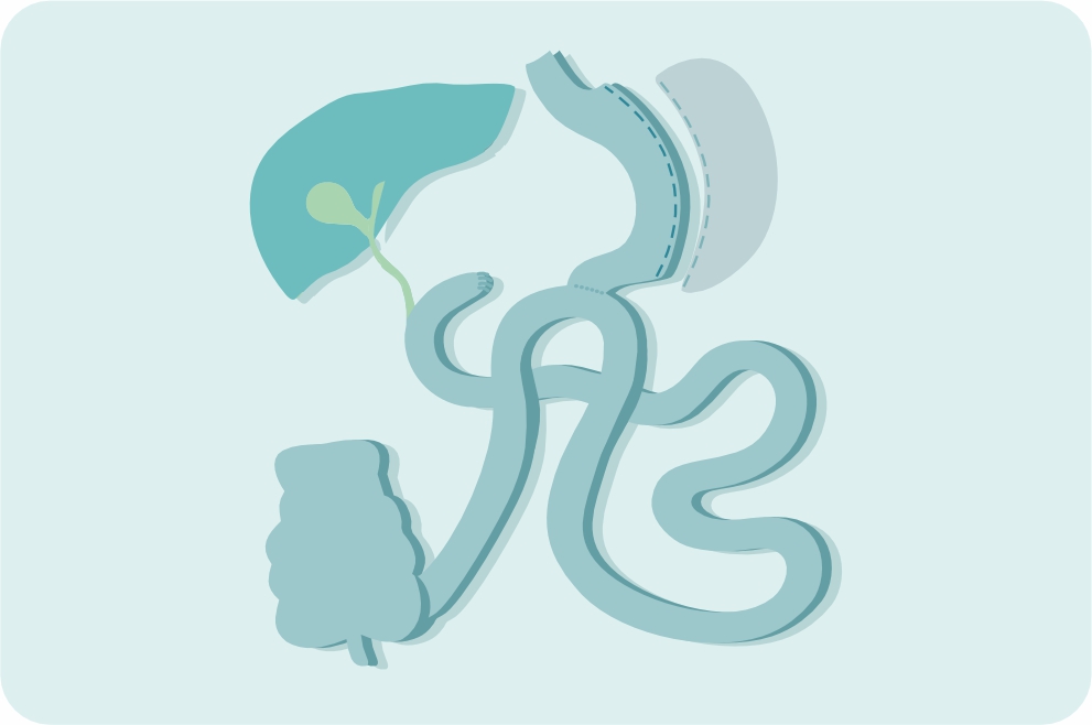 Операция SADI 